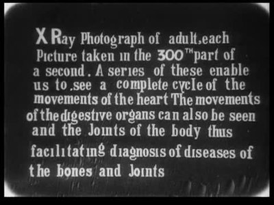 Dr. Macintyre's X-Ray Film